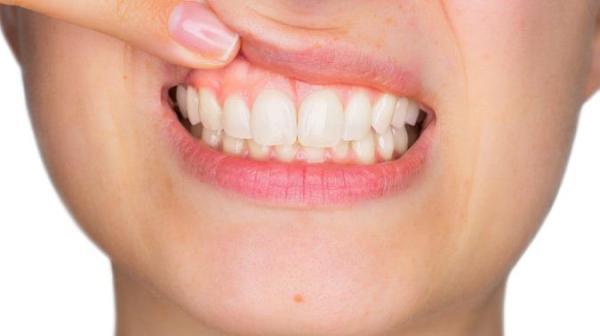 از دلیل تا درمان عفونت دندان